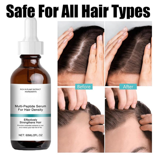 The Ordinary Multi-Peptide Serum for Hair Density – Advanced Hair & Scalp Treatment