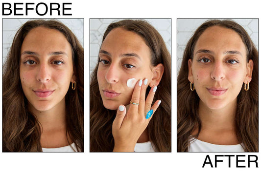 CeraVe Skin Renewing Night Cream – Deep Moisturizing Overnight Face Cream
