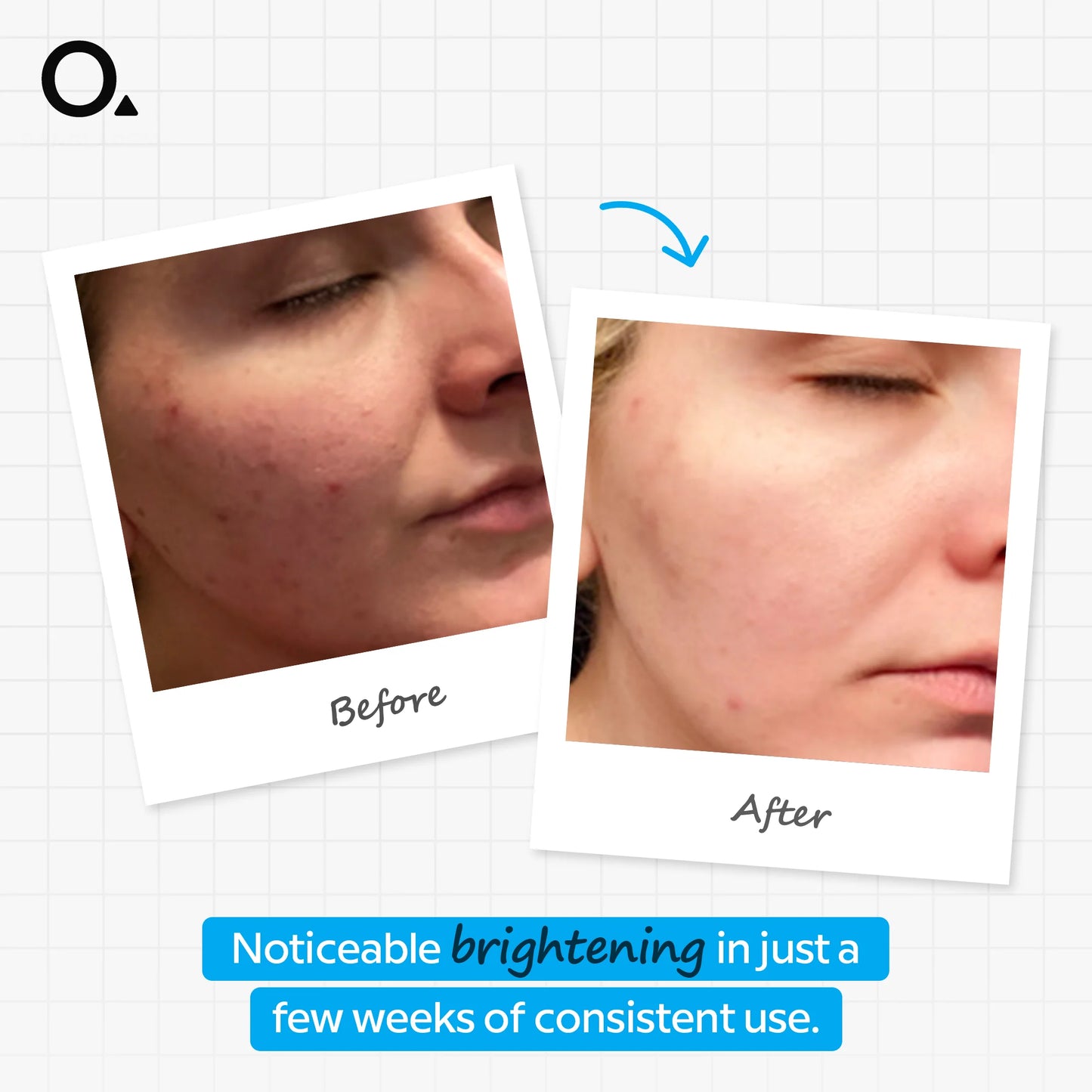The Ordinary Ascorbic Acid 8% + Alpha Arbutin 2% – Brightening Serum