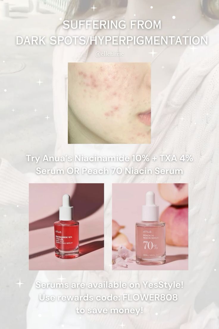 ANUA Niacinamide 10% + TXA 4% Serum – Brightening & Dark Spot Care Serum