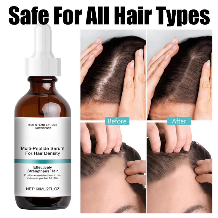 The Ordinary Multi-Peptide Hair Serum – Hair Density Treatment