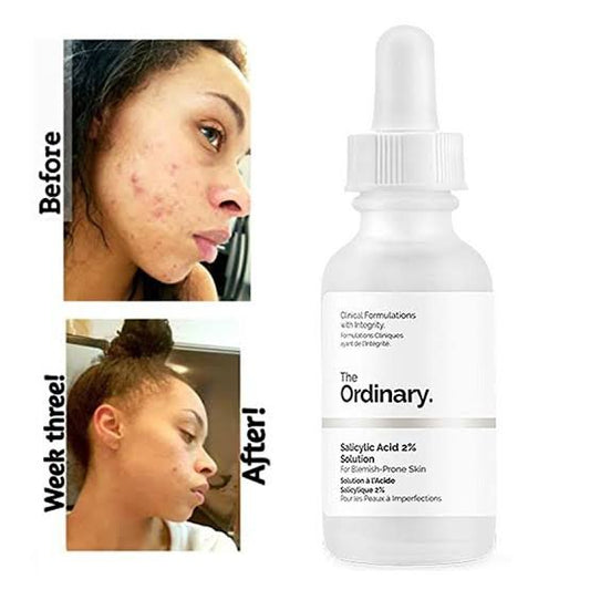 The Ordinary Salicylic Acid 2% Solution – Blemish Control Serum 30 ml