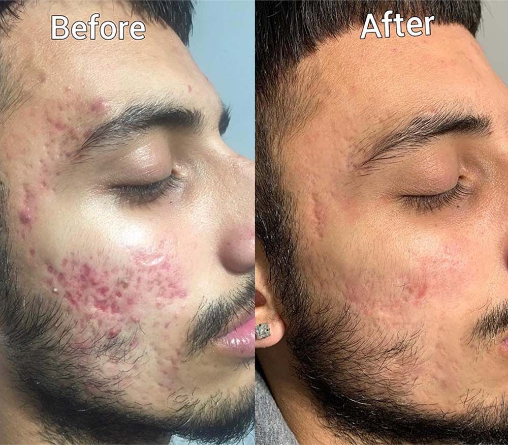 Cetaphil Brightening Night Cream Dark Spot Repair