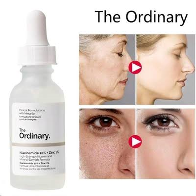 The Ordinary Niacinamide 10% + Zinc 1% – Oil Control & Brightening Serum | 30ml