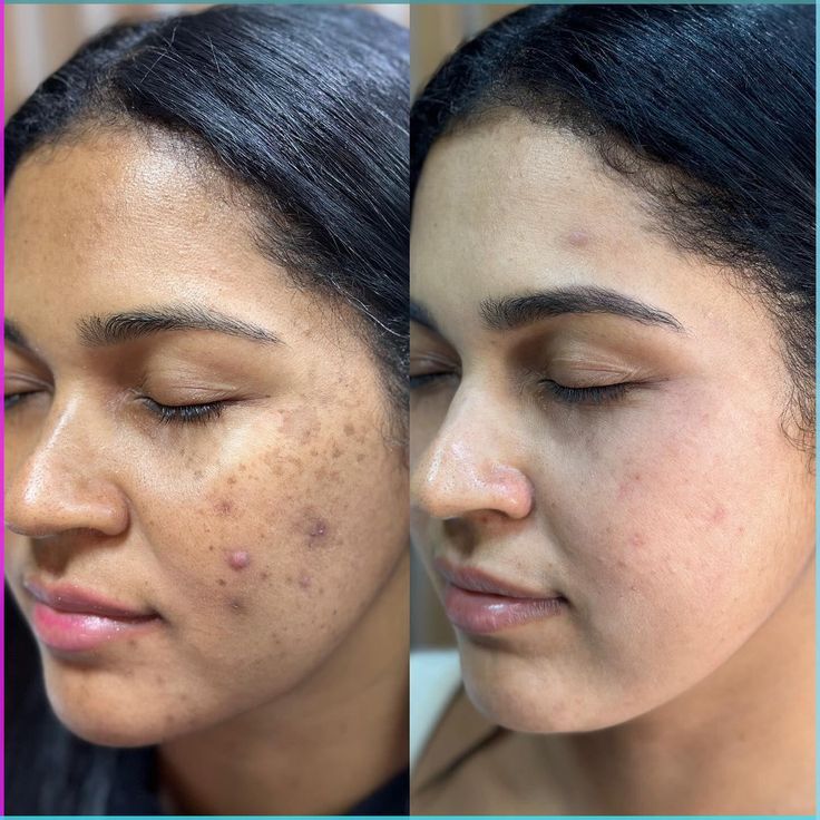 Cetaphil Brightening Night Cream Dark Spot Repair